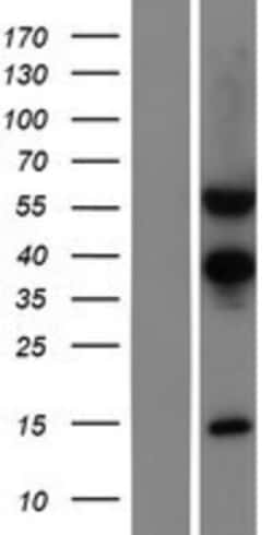 Novus Biologicals&trade;&nbsp;TSEN54 Overexpression Lysate