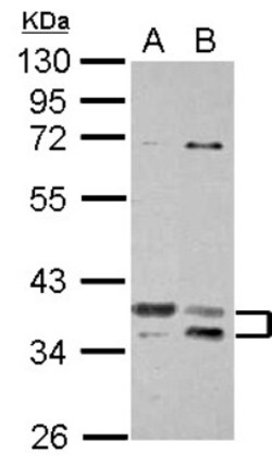TSFM Antibody, Novus Biologicals 0.1mL; Unlabeled:Antibodies, Polyclonal