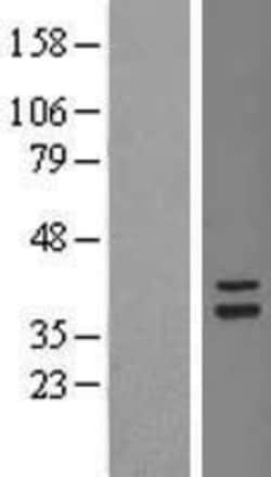 Novus Biologicals&trade;&nbsp;TSFM Overexpression Lysate