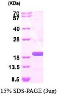 Novus Biologicals&trade;&nbsp;Recombinant Human TSG101 His Protein