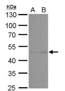 TSG101 Antibody (4A10), Novus Biologicals 0.1mL; Unlabeled:Antibodies,