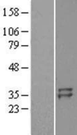 Novus Biologicals™ TSG-6 Overexpression Lysate