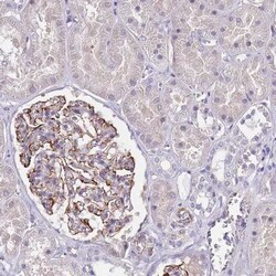 TSGA13 Antibody, Novus Biologicals:Antibodies:Primary Antibodies
