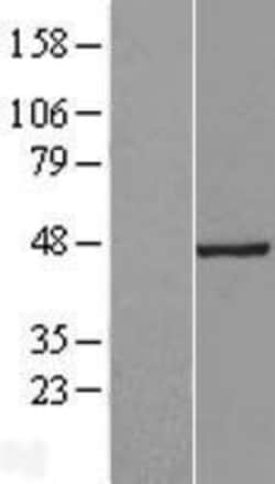 Novus Biologicals&trade;&nbsp;TSGA14 Overexpression Lysate