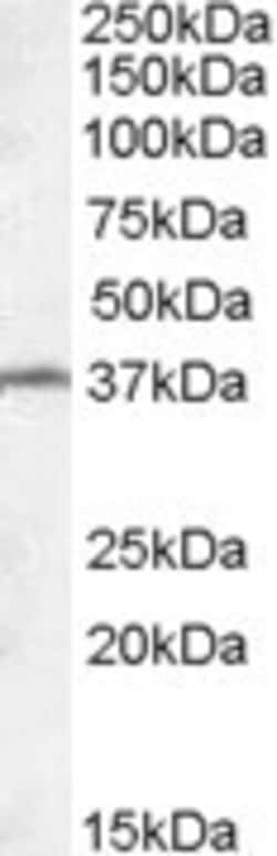 TSGA2 Antibody, Novus Biologicals 0.1mg; Unlabeled:Antibodies, Polyclonal