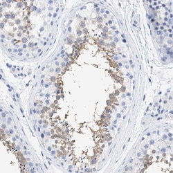 TSGA2 Antibody, Novus Biologicals 25 &mu;L; Unlabeled:Antibodies, Polyclonal