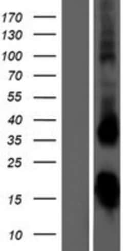 Novus Biologicals&trade;&nbsp;TSH beta Overexpression Lysate