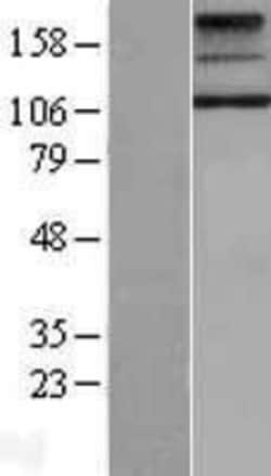Novus Biologicals™ TSHR Overexpression Lysate
