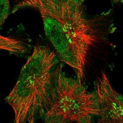 TSHZ2 Antibody, Novus Biologicals 0.1mL; Unlabeled:Antibodies, Polyclonal