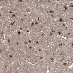 TSHZ2 Antibody, Novus Biologicals 0.1mL; Unlabeled:Antibodies, Polyclonal