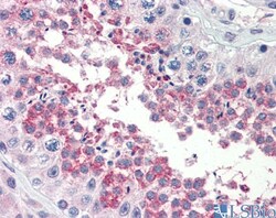 TSKS Antibody, Novus Biologicals 100&mu;L; Unlabeled:Antibodies, Polyclonal