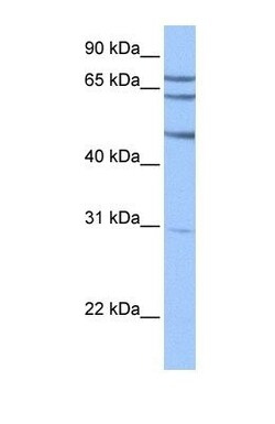 TSKS Antibody, Novus Biologicals 100&mu;L; Unlabeled:Antibodies, Polyclonal