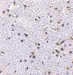 TSLP Antibody - BSA Free, Novus Biologicals 0.1 mg, Unconjugated:Antikörper