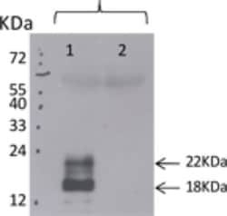 TSLP Antibody (210H1), Novus Biologicals 0.1mg; Unlabeled:Antibodies, Monoclonal