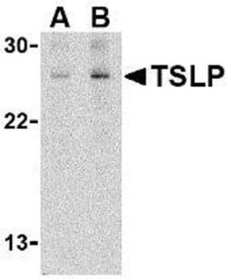 TSLP Antibody - BSA Free, Novus Biologicals:Antikörper:Primärantikörper