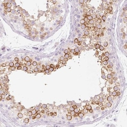 TSP50 Antibody, Novus Biologicals 0.1mL; Unlabeled:Antibodies, Polyclonal