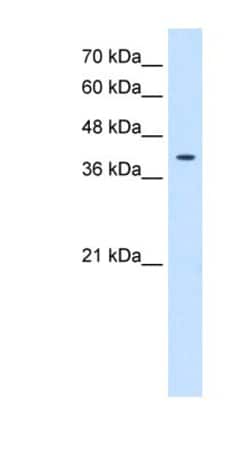 TSPAN12 Antibody, Novus Biologicals 100 &mu;L | Buy Online | Novus Biologicals | Fisher Scientific