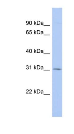 TSPAN12 Antibody, Novus Biologicals 100&mu;L; Unlabeled:Antibodies, Polyclonal