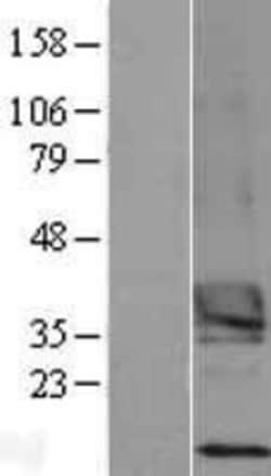 Novus Biologicals™ TSPAN15 Overexpression Lysate