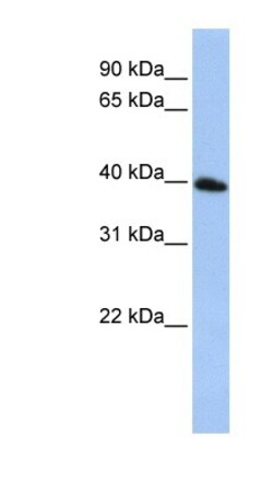 TSPAN17 Antibody, Novus Biologicals:Antibodies:Primary Antibodies