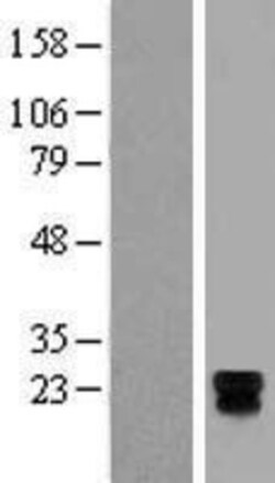 Novus Biologicals&trade;&nbsp;TSPAN18 Overexpression Lysate