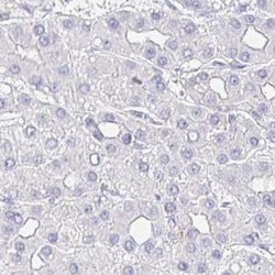 TSPAN19 Antibody, Novus Biologicals 25 &mu;L | Buy Online | Novus Biologicals | Fisher Scientific