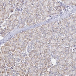 TSPAN19 Antibody, Novus Biologicals 25 &mu;L | Buy Online | Novus Biologicals | Fisher Scientific