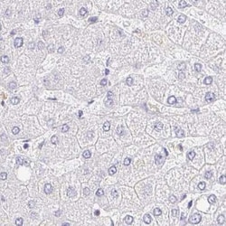 TSPAN19 Antibody, Novus Biologicals 25 &mu;L | Buy Online | Novus Biologicals | Fisher Scientific