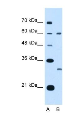 TSPAN32/TSSC6 Antibody, Novus Biologicals:Antibodies:Primary Antibodies