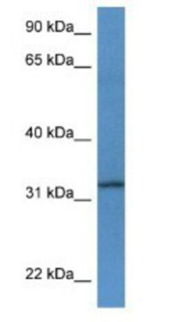 TSPAN33 Antibody, Novus Biologicals:Antibodies:Primary Antibodies