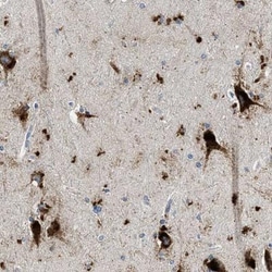 TSPAN3 Antibody, Novus Biologicals:Antibodies:Primary Antibodies