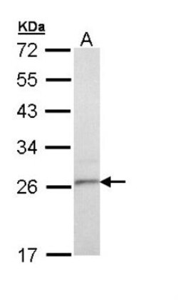 TSPAN6 Antibody, Novus Biologicals 0.1mg; Unlabeled:Antibodies, Polyclonal