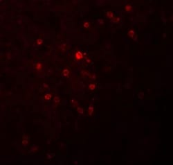 TSPAN9 Antibody - BSA Free, Novus Biologicals 0.1mg; Unlabeled:Antibodies,