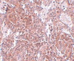 TSPAN9 Antibody - BSA Free, Novus Biologicals 0.1mg; Unlabeled:Antibodies,