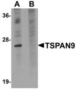 TSPAN9 Antibody - BSA Free, Novus Biologicals 0.1mg; Unlabeled:Antibodies,