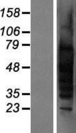 Novus Biologicals&trade;&nbsp;TSPY1 Overexpression Lysate