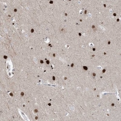 TSPYL1 Antibody, Novus Biologicals 0.1mL; Unlabeled:Antibodies, Polyclonal