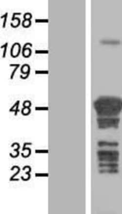 Novus Biologicals&trade;&nbsp;TSPYL4 Overexpression Lysate
