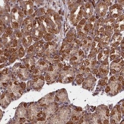 TSPYL4 Antibody, Novus Biologicals 0.1mL; Unlabeled:Antibodies, Polyclonal