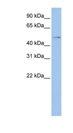 TSPYL4 Antibody, Novus Biologicals:Antibodies:Primary Antibodies