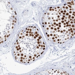 TSPYL6 Antibody, Novus Biologicals 0.1mL; Unlabeled:Antibodies, Polyclonal
