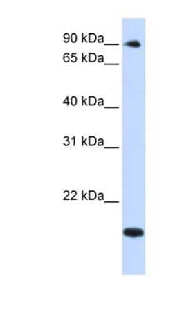 TSR1 Antibody, Novus Biologicals:Antibodies:Primary Antibodies