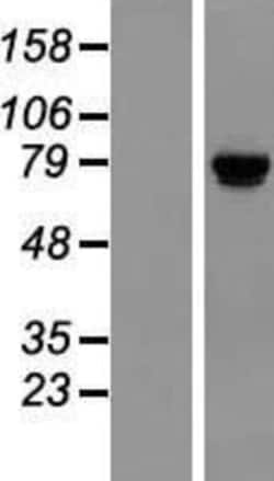Novus Biologicals&trade;&nbsp;TSR1 Overexpression Lysate
