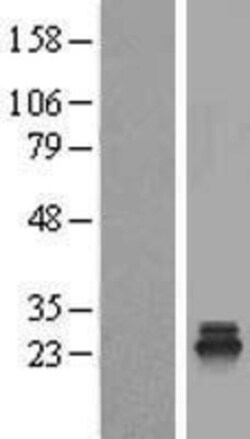 Novus Biologicals&trade;&nbsp;TSR2 Overexpression Lysate