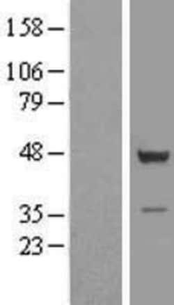 Novus Biologicals™ TSSC1 Overexpression Lysate