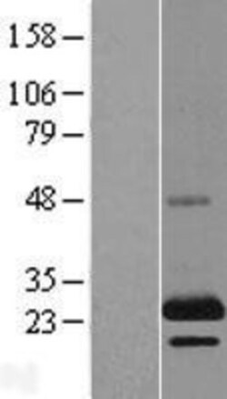 Novus Biologicals™ TSSC3 Overexpression Lysate