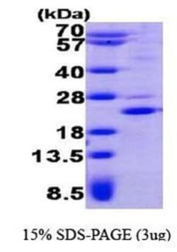 Novus Biologicals Recombinant Human TSSC3 His Protein 0.05mg; Unlabeled | Buy Online | Novus Biologicals&trade; | Fisher Scientific