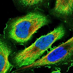 TSSC4 Antibody, Novus Biologicals 25 &mu;L; Unlabeled:Antibodies, Polyclonal