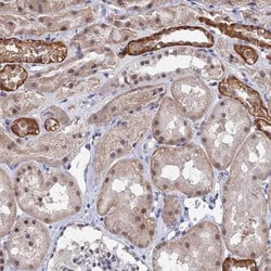 TSSC4 Antibody, Novus Biologicals 25 &mu;L; Unlabeled:Antibodies, Polyclonal