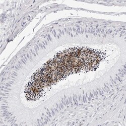 TSSK1 Antibody, Novus Biologicals 0.1mL; Unlabeled:Antibodies, Polyclonal